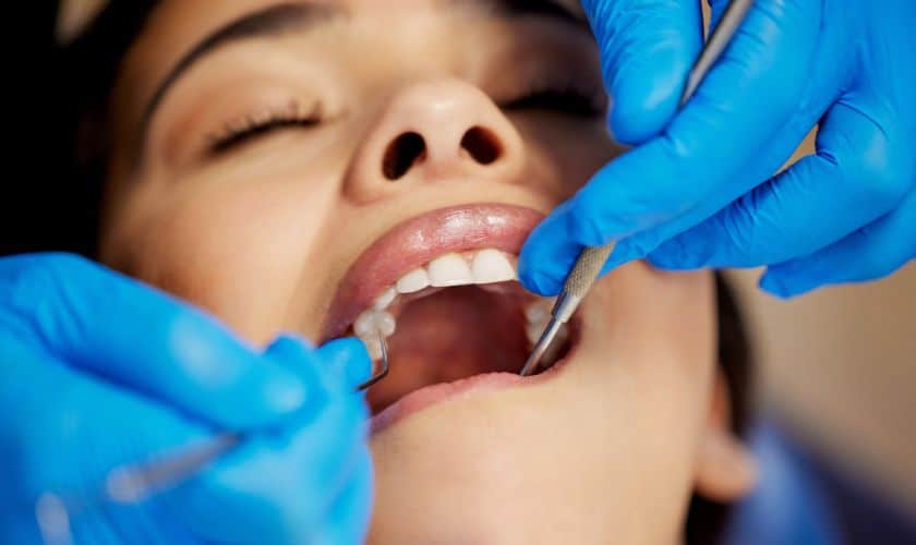 Tooth extraction infection