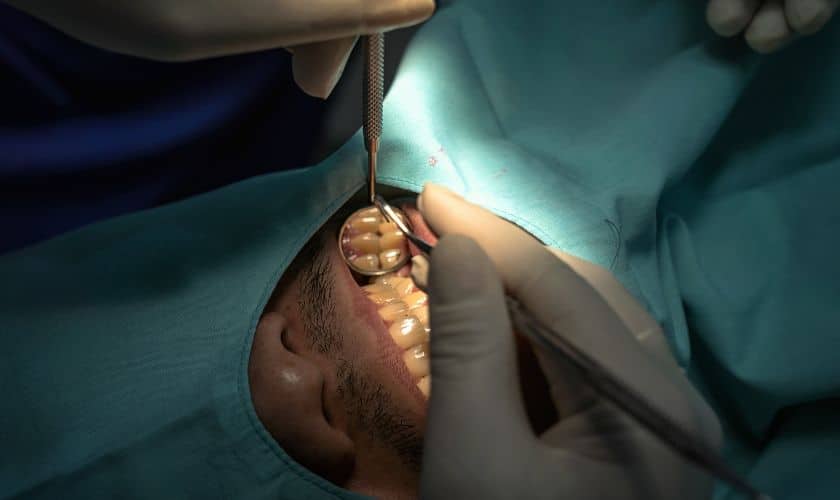 Root Canal Treatment