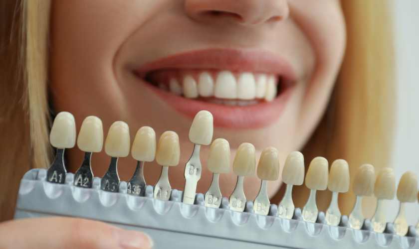How to Care for Your Cosmetic Dental Procedures: Tips and Advice