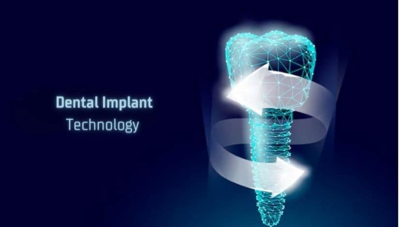 The Exciting Innovations of Dental Implant in Grand blanc for 2024