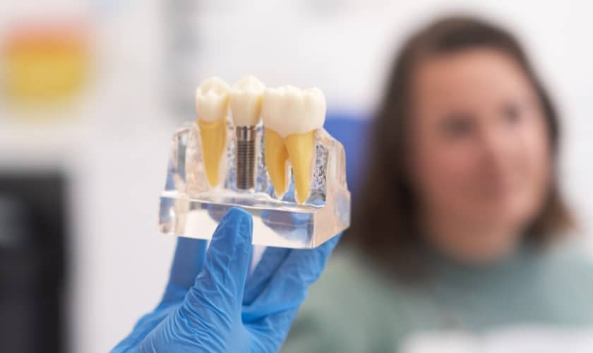 best age for dental implants